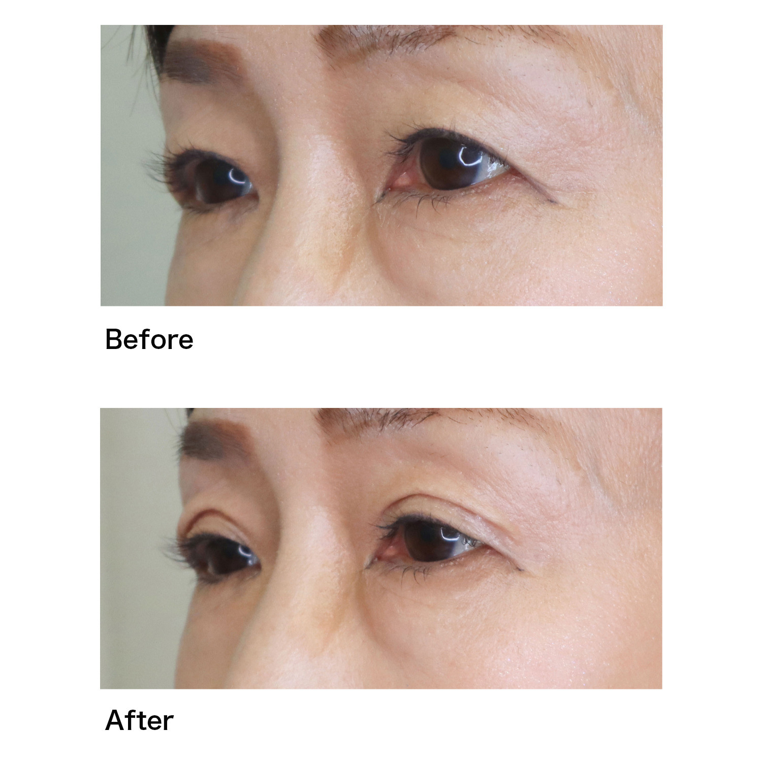 モアフロウ 特殊な人工皮膜を形成し 明るく朗らかな 二重の目元を演出！ アイリッドリキッド エスポアージュ ２本セット