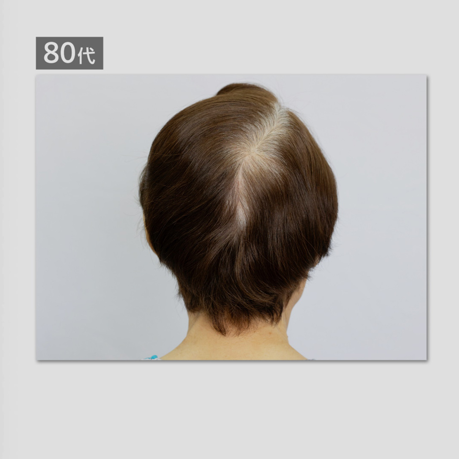 ララチュー メイク効果で薄毛と白髪を 簡単瞬時にカバー ヘアファンデーション プレミアムＥＸ ＜ダークブラウン＞ ２個分スペシャルセット 